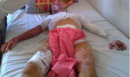 Đốt vợ đến tử vong vì không cho nhậu