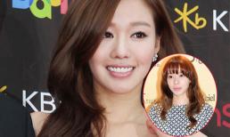 Kim Ah Joong bị nghi ngờ dao kéo