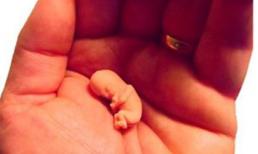 Kinh hoàng những kiểu phá thai có một không hai