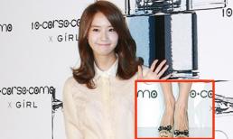 SNSD: Yoona lộ chân gân guốc kém thẩm mỹ