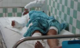 Tạt axit người yêu vì không chịu tiếp tục "sống thử"