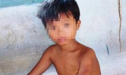 Một vụ bạo hành trẻ em dã man ngay trong ngày 1/6