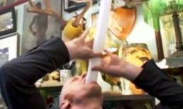 Nuốt chửng quả bóng bay dài gần 1m vào vụng