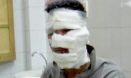 Người thoát chết kể lại vụ nổ mìn ở tiệm vàng