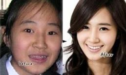 Những sao Hàn dính nghi án phẫu thuật thẩm mỹ