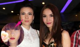 Yến Nhi tái xuất tại sự kiện với chiếc mũi "kì lạ"!