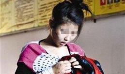 Thiếu nữ bị bạn trai giam cầm, đánh đập thê thảm