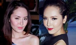 Phương Linh dính nghi án nâng mũi