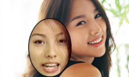 Sao 'lên đời' nhan sắc nhờ... răng