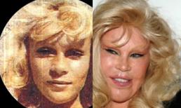 "Lật mặt" sao Hollywood có nghi án phẫu thuật (P3)