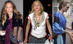 Sao lộ làn da "giun dế" kinh dị