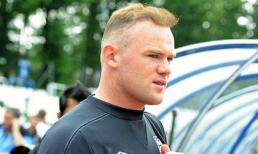 Chữa hói đầu, Rooney trở thành đàn ông bất lực?