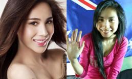 Mỹ nhân châu Á đẹp hơn nhờ... niềng răng