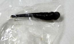 Vắt to như pin tiểu sống trong kh&#237; quản b&#233; 6 tuổi