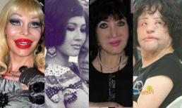 Thảm họa phẫu thuật biến mỹ nữ thành "dị nhân"