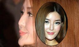 Chiếc cằm kì dị của người mẫu ngực lệch