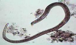 Hoại tử chân tay, thậm chí tử vong vì ăn tiết canh