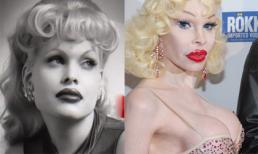 Hậu quả khó đoán của việc làm đẹp bằng 'dao kéo'