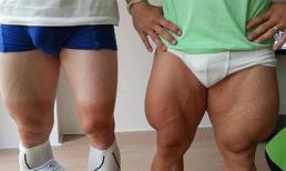 Cặp đùi gây sốc của cua- rơ người Đức!