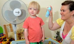 Cậu bé mắc hội chứng 'ma cà rồng'