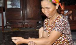 Xanh mặt chuyện một phụ nữ “đẻ” ra đỉa dài 30cm, to bằng cổ tay