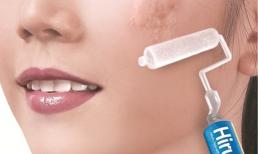 Đừng để sẹo xuất hiện trên gương mặt bạn