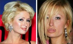 "Phong trào" bơm môi của sao Hollywood