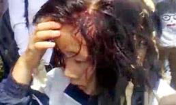 Shock nặng với clip nữ sinh đánh nhau vỡ đầu