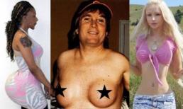 Những ca phẫu thuật điên rồ nhất