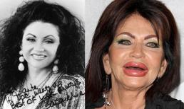 "Hoảng hồn" trước khuôn mặt biến dạng vì thẩm mỹ của sao Hollywood