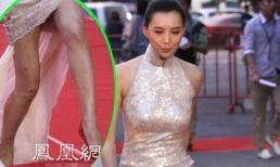 Sao hoa ngữ lộ chân "ghẻ lở kinh dị" cạnh loạt người đẹp cùng xấu