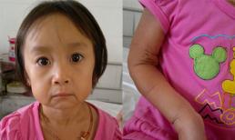 Tội nghiệp bé gái 3 tuổi mặt già như bà lão