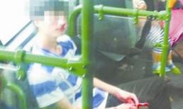 Tát hộc máu thanh niên tàn tật vì không nhường ghế