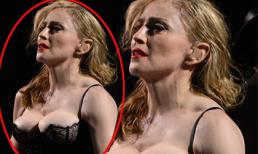 Madonna chèn ép ngực 'trồi' lên tận cổ