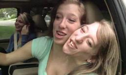 Cuộc sống phi thường của 2 cô gái trên cùng một cơ thể