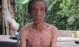 Quảng Nam: Người đàn ông "bong bóng"