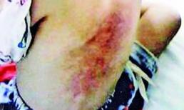 Phẫn nộ c&#244; gi&#225;o xui cả lớp đ&#225;nh học sinh 6 tuổi