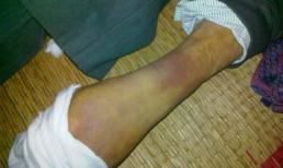 HN: 1 người dân chết bất thường ở đồn CA 