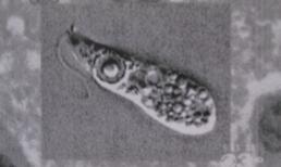 "Amip ăn não người": Dư luận lo lắng, chuyên gia trấn an