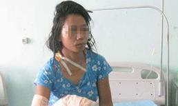 Bị chồng đánh đập dã man vì không biết... 'ân ái'