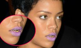 Rihanna "gây hoảng" với răng vàng khè, môi tím ngắt