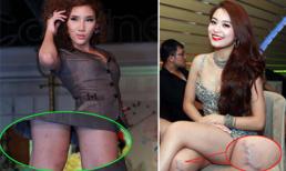 Cận những đôi chân mụn sẹo "kinh dị" của mỹ nhân