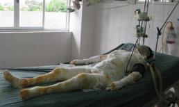 Giây phút kinh hoàng của 9 người bị cháu ruột tưới xăng thiêu sống