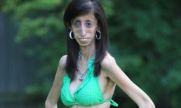 Cô gái xấu xí nhất thế giới trông thế nào?