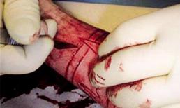 Hãi hùng thú chơi lột da