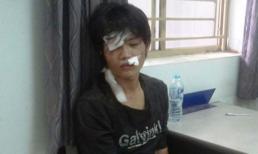 Giáp mặt tên cướp giết người giữa phố Sài Gòn