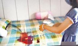 Lời kể đau đớn của người bị bạn gái cắt 'của quý' đem giấu