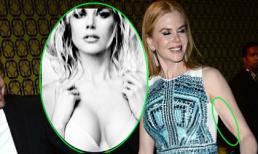 'Thiên Nga Úc' Nicole Kidman bỗng gầy gò và xuống sắc tàn tạ