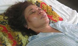 Kết luận điều tra vụ mẹ tố hai bố con bạo hành