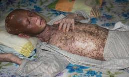 Đáng sợ như ký sinh trùng chó, mèo